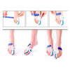 Bunion Adjuster Orthotics