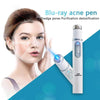 Face Acne Laser Pen