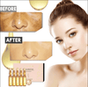 Whitening Spotless Ampoule Serum (Set of 7)